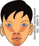 teteloup1