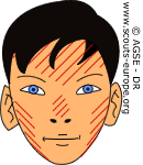 teteloup5